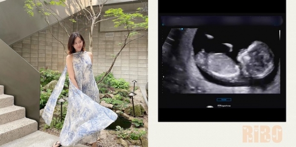 구재이 결혼 2년만에 임신 [구재이 SNS]